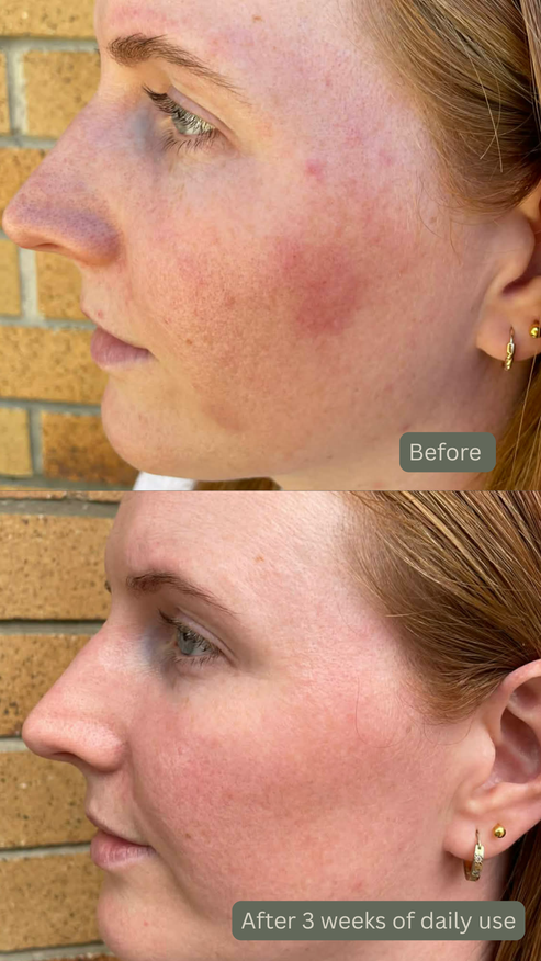 The Audrey Age Renewal Mist