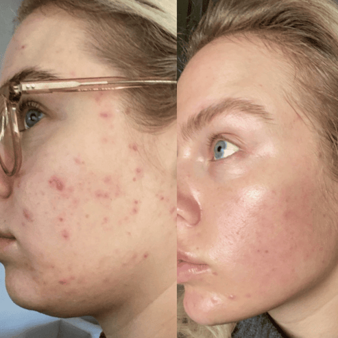 Sophia Serum