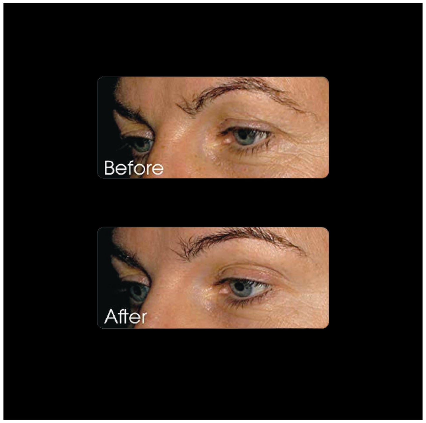Miracle Collagen 100g